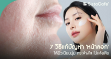 External Link: ลอง 7 วิธีแก้ปัญหา 'หน้าลอก' ให้ผิวเนียนนุ่ม บอกลาหน้าเป็นขุย ไม่ต้องแสบหน้าในหน้าหนาว | บทความของ Pearrisa | SistaCafe ครบเครื่องเรื่องบิวตี้