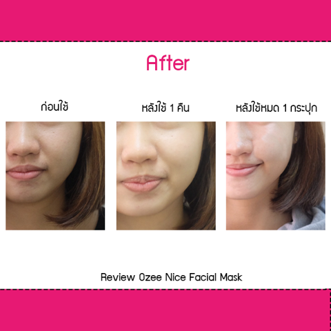 รูปภาพหน้าปกบทความ:"รีวิว Ozee Nice Facial Mask ผิวดีจนใครๆ ต้องอิจฉา ง่ายๆ แค่นี้เอง..."