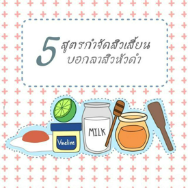 รูปภาพหน้าปกบทความ:5 สูตรกำจัดสิวเสี้ยน บอกลาสิวหัวดำ