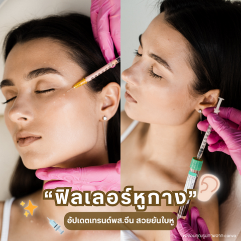 รูปภาพหน้าปกบทความ:ฟิลเลอร์หูกาง อัปเดตเทรนด์พส.จีน สวยยันใบหู