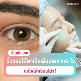 รูปภาพหน้าปกบทความ:ริ้วรอยใต้ตาเป็นเส้น เกิดจากอะไร? แก้ไขได้หรือเปล่า?