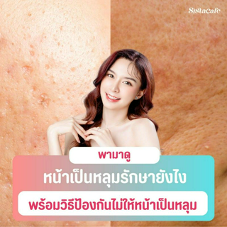 ภาพหน้าปกบทความ:title