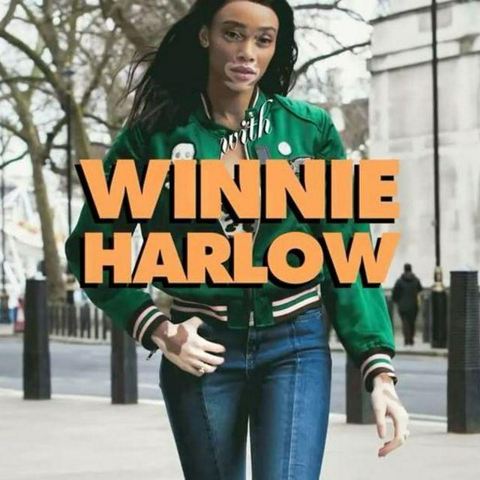 รูปภาพหน้าปกบทความ:Winnie Harlow นางแบบสาวผู้ถ่ายทอดความรู้สึกสุดยูนีคให้กับ Converse Chuck Taylor All Star