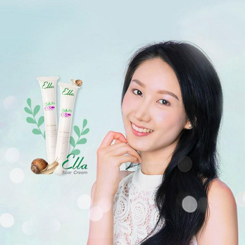 รูปภาพหน้าปกบทความ:หมดปัญหาทุกรอยแผลเป็น! 'Ella Scar Cream' ตัวช่วยเพิ่มความมั่นใจให้กับสาวๆอีกครั้ง ✨