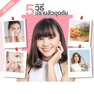 ภาพหน้าปกบทความ:title