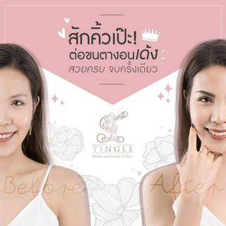 ภาพหน้าปกบทความ:title