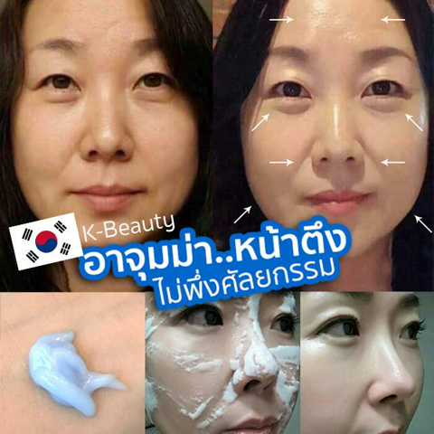 รูปภาพหน้าปกบทความ:ไอเทมเด็ด K-BEAUTY อาจุมม่าหน้าตึง..ไม่พึ่งศัลยกรรม