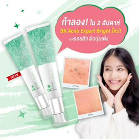 รูปภาพหน้าปกบทความ:ท้าลอง! ใน 2 สัปดาห์ BK Acne Expert Bright ใหม่! ลดรอยสิว ผิวนุ่มเด้ง ✨