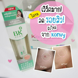 รูปภาพหน้าปกบทความ:เวิร์คมาก! ไอเทมลดรอยสิวตัวใหม่ จาก Konvy 😘