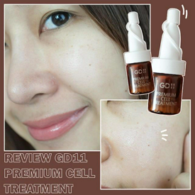 รูปภาพหน้าปกบทความ:รีวิวสกินแคร์กู้ผิวจากเกาหลี GD11 PREMIUM CELL TREATMENT