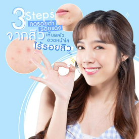 รูปภาพหน้าปกบทความ:3 Steps ลดรอยดำ รอยแดง จากสิว เห็นผลไว พร้อมอวดหน้าใสไร้รอยสิว    