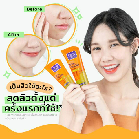 รูปภาพหน้าปกบทความ:เป็นสิวใช้อะไร? C&C Acne Clearing ปังสุด ลดสิวตั้งแต่ครั้งแรกที่ใช้!