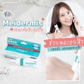 รูปภาพหน้าปกบทความ: ชี้เป้า Meidermis เจลแต้มสิวสุดปัง ช่วยลดรอยสิว รอยดำ รอยแดงจากสิว !