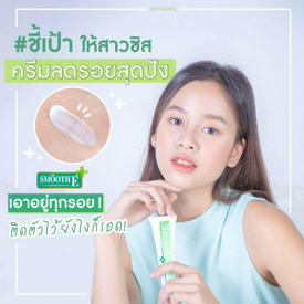 รูปภาพหน้าปกบทความ:ชี้เป้าให้สาวซิส กับครีมลดรอยสุดปัง Smooth E Cream เอาอยู่ทุกรอย ติดตัวไว้ ยังไงก็รอด!