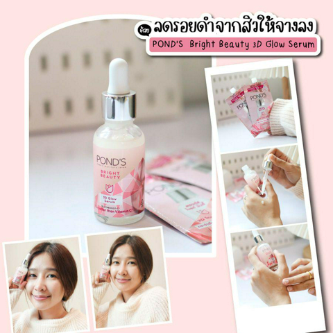 รูปภาพหน้าปกบทความ:ลดรอยดำจากสิวให้จางลง ด้วยเซรั่มจบทุกจุด POND’S  Bright Beauty 3D Glow Serum