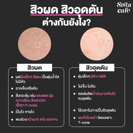 ภาพประกอบบทความ:sistacafe-assets:____%2Fc%2F90784%2F4c0e16ad-0216-4a08-b4b8-57520e987489?v=20240823180617