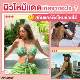 รูปภาพหน้าปกบทความ:ผิวไหม้แดด เกิดจากอะไร ? สกินแคร์ตัวไหนแก้ผิวไหม้แดดได้บ้าง ?