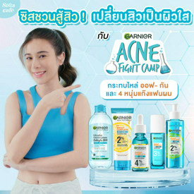 รูปภาพหน้าปกบทความ:ชวนซิสมา สู้สิว ! เปลี่ยนสิวเป็นผิวใส กับ Acne Fight Camp