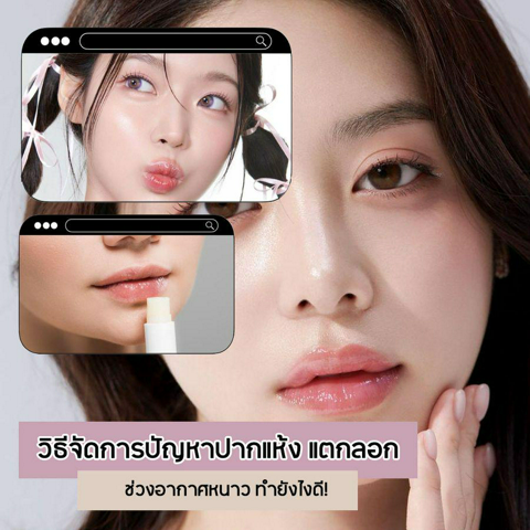 รูปภาพหน้าปกบทความ:วิธีแก้ปัญหาปากแตก รวม 6 วิธีจัดการปากแห้งลอกช่วงหน้าหนาว ทำยังไงดี ?