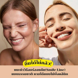 รูปภาพหน้าปกบทความ:วิธีลดร่องแก้ม Smile Line ยิ้มได้ไม่กลัว หายธรรมชาติแบบไม่พึ่งคลินิก