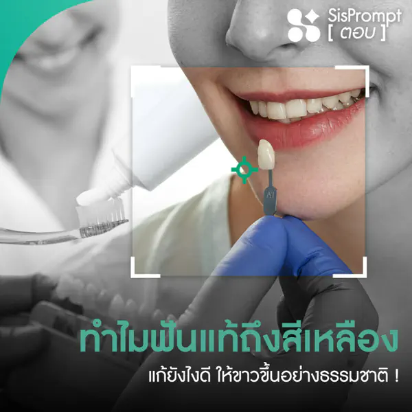 รูปภาพหน้าปกบทความ:แจกทริคแก้ฟันเหลือง ให้ขาวขึ้นอย่างธรรมชาติ!