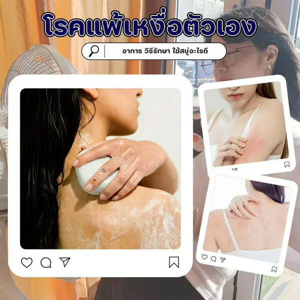 รูปภาพหน้าปกบทความ:โรคแพ้เหงื่อตัวเอง เป็นได้ด้วยเหรอ? ชวนรู้จักพร้อมแนะนำสบู่ลดเหงื่อ