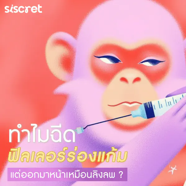 รูปภาพหน้าปกบทความ:ทำไมฉีดฟิลเลอร์ร่องแก้ม แต่ออกมาหน้าเหมือนลิงลพ?
