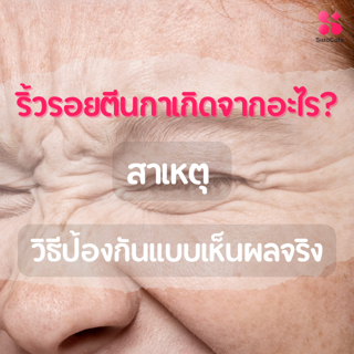 ภาพหน้าปกบทความ:title