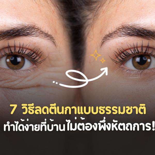 รูปภาพหน้าปกบทความ:7 วิธีลดตีนกาแบบธรรมชาติ ทำได้ง่ายที่บ้าน ไม่ต้องพึ่งหัตถการ!!