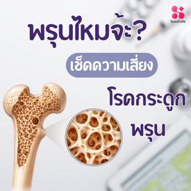 รูปภาพหน้าปกบทความ:พรุนไหมจ้ะ? เช็กความเสี่ยงโรคกระดูกพรุน