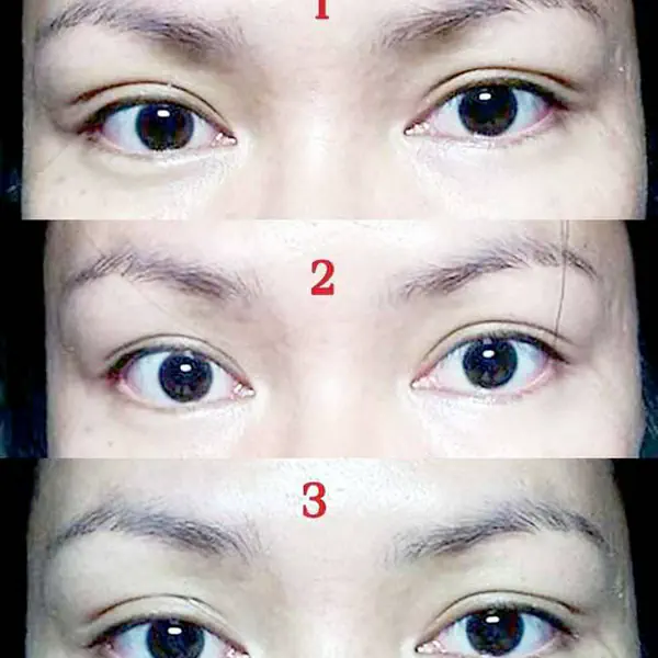 รูปภาพหน้าปกบทความ:Howto : 4 วิธี ตาสองชั้นแบบง่ายๆ ไม่ง้อศัลยกรรม!!