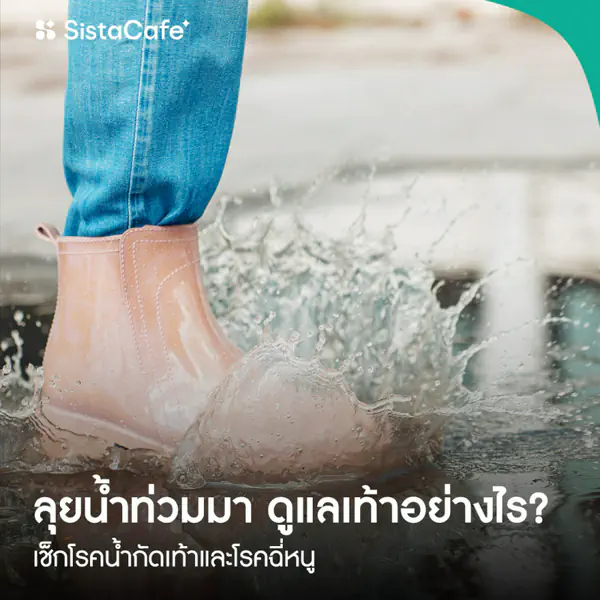 รูปภาพหน้าปกบทความ:ลุยน้ำท่วมมา ดูแลเท้าอย่างไร? เช็กโรคน้ำกัดเท้าและโรคฉี่หนู