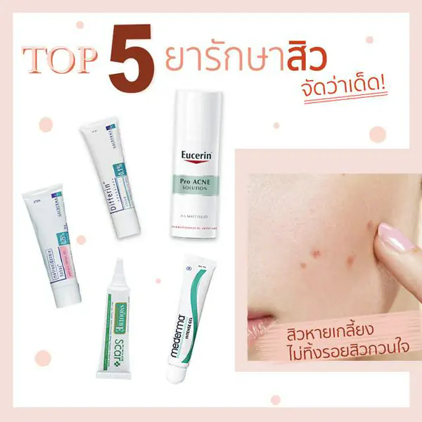 รูปภาพหน้าปกบทความ:ใช้แล้วต้องซื้อซ้ำ! 5 ยารักษาสิว แถมรักษารอยดำรอยแดงจากสิว หายกริบ!