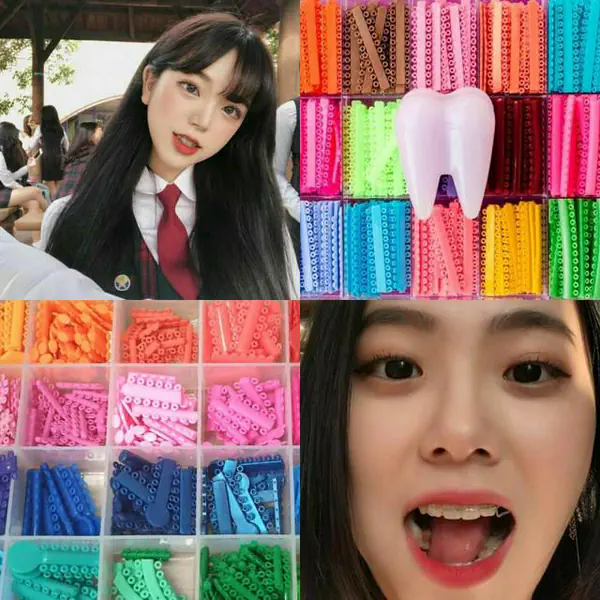 รูปภาพหน้าปกบทความ:ยิ้มรับดวงเฮง! ด้วยการเลือก " สียางจัดฟันเสริมดวงวันเกิด " ✨ สายมูเชิญมาดูด่วนๆ