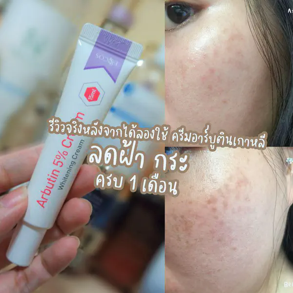 รูปภาพหน้าปกบทความ:รีวิว ครีมอาร์บูตินเกาหลี ( Arbutin 5% ) แบรนด์ E&COS ตัวเด็ดช่วยเรื่อง ฝ้า กระ รอยแดงสิว จางลงได้อีก 😊