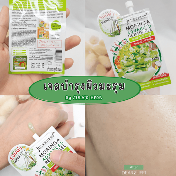 รูปภาพหน้าปกบทความ:แนะนำไอเทม ‘เจลมะรุมจุฬาเฮิร์บสูตรใหม่’ ที่ช่วยลดรอยสิว ให้หลุมสิวตื้น เผยผิวใสขึ้น