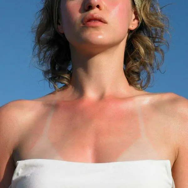 รูปภาพหน้าปกบทความ:ไขข้อสงสัย ? ทำความรู้จักกับ “ After Sun “ คืออะไร ควรใช้ตอนไหน ☀️