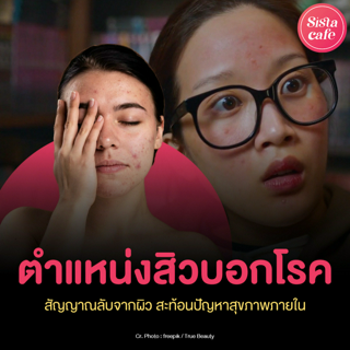 ภาพหน้าปกบทความ:title