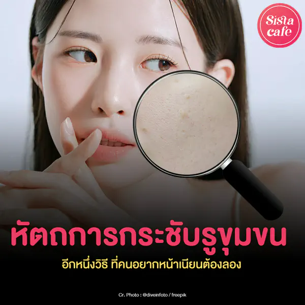 รูปภาพหน้าปกบทความ:หัตถการกระชับรูขุมขน อีกหนึ่งวิธี ที่คนอยากหน้าเนียนต้องลอง