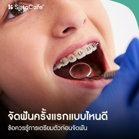 รูปภาพหน้าปกบทความ:จัดฟันครั้งแรกแบบไหนดี และข้อควรรู้การเตรียมตัวก่อนจัดฟัน