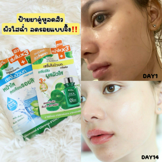 ภาพหน้าปกบทความ:title