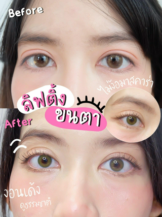 ภาพหน้าปกบทความ:title