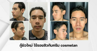 ภาพหน้าปกบทความ:title