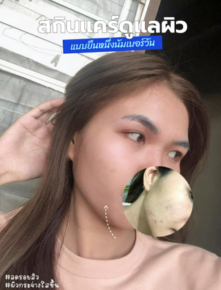 ภาพหน้าปกบทความ:title