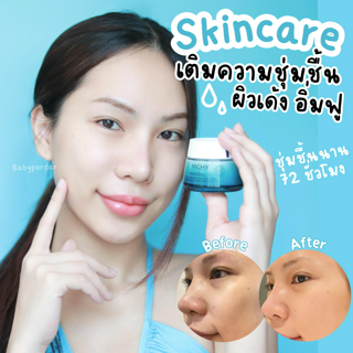 ภาพหน้าปกบทความ:title