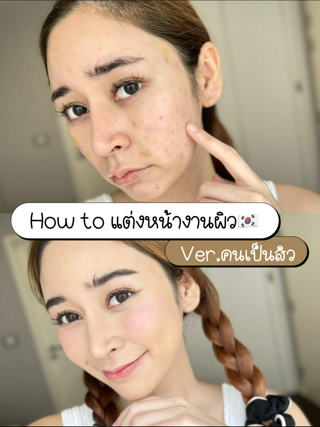 ภาพหน้าปกบทความ:title