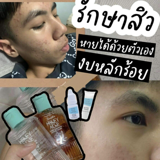 ภาพหน้าปกบทความ:title