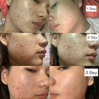 ภาพหน้าปกบทความ:title