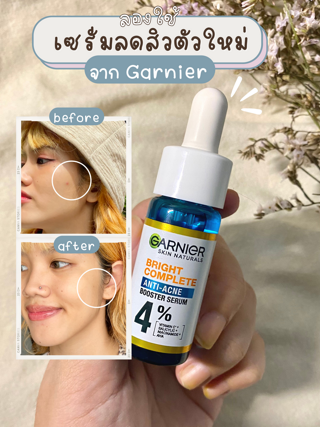 ภาพหน้าปกบทความ:title