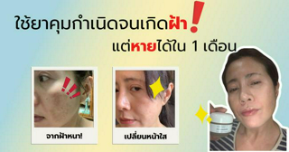 ภาพหน้าปกบทความ:title